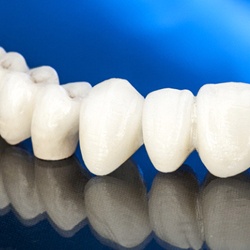 All-ceramic dental bridge