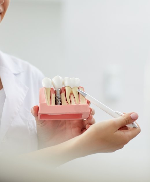 Model comparing dental implant supported replacement tooth to natural teeth