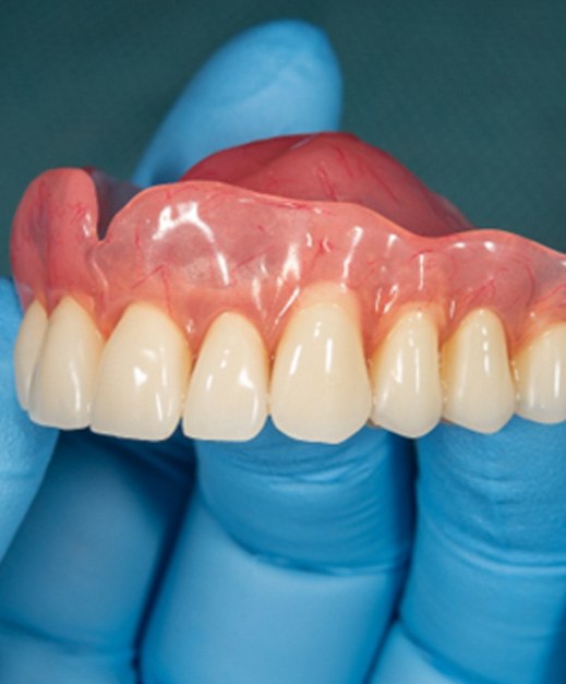 gloved hand holding an upper denture