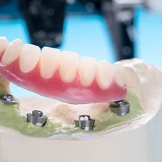  Model denture resting on top of dental implants in a plaster mold
