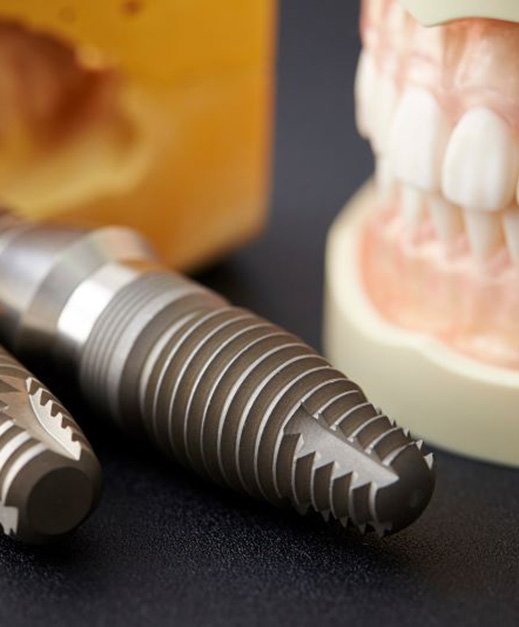 Enlarged dental implants next to tooth model