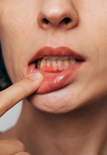 Woman with gum irritation