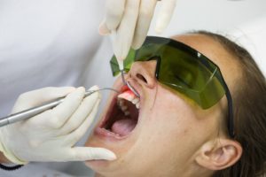 Dentist using laser for crown lengthening