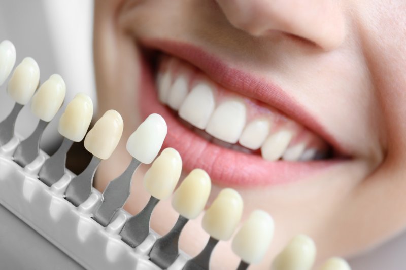 A close-up of a patient’s smile