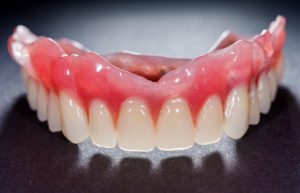 Full upper denture