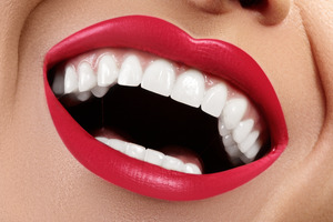 Close-up of big smile with brilliant teeth and lipstick
